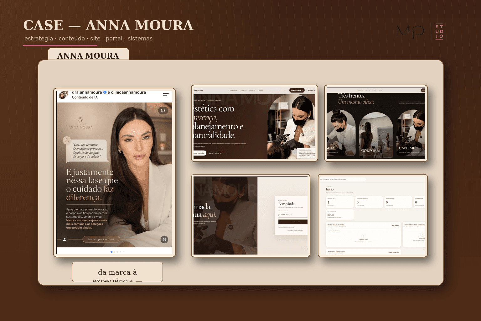 Ficha do case Anna Moura da MPStudio: post real do Instagram da Clínica Anna Moura e telas reais do site, do portal do paciente e de um sistema interno desenvolvidos para a marca